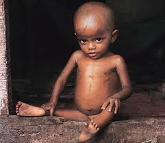Stunted-growth-and-low-amino-acids-in-diet-of-children-on-HWN-INSIGHTS