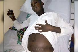 Isa-Hamman,-the-kidney-theft-patient-still-alive-on-HWN-TERROR