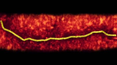 Vaccine-Development-For-Mers,-Lassa-fever-and-Nipah-viruses-on-HWN-VACCINES