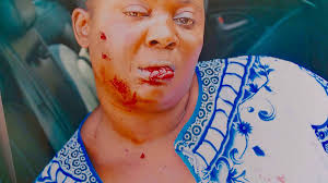 Ade-Basket-Thugs,-Beats-Woman-To-A-Comatose-State-on-HWN-TERROR