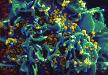 Shock-and-kill-may-destroy-HIV-on-HWN-HIV-UPDATE