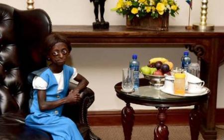 Ontlametse-Phalatse-succumbs-to-progeria-on-HWN-RARE-DISEASE
