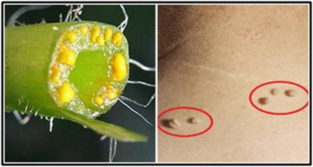 Annihilating-Warts-on-HWN-WARTS-UPDATE
