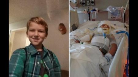 Texas-Boy-Set-On-Fire,-Fights-For-Life-On-HWN-HORROR